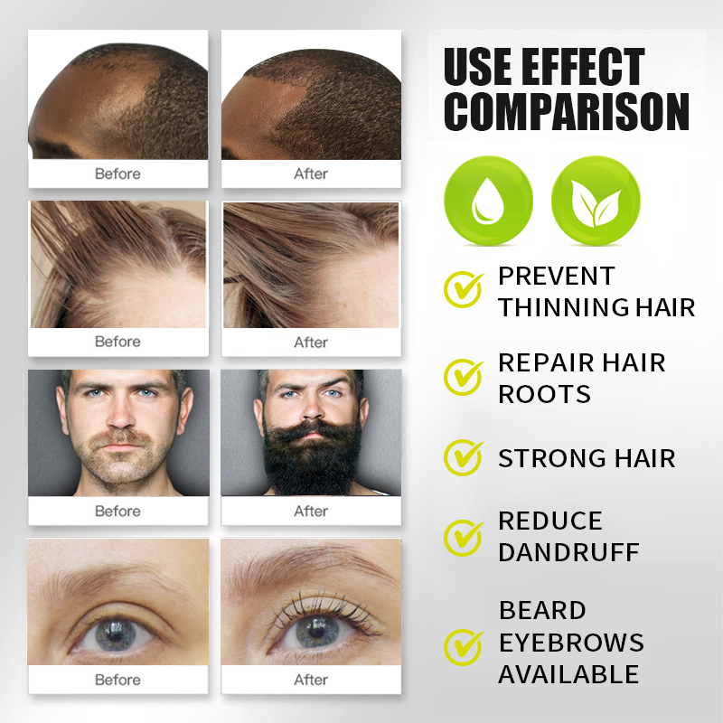 PURC Biotin Hızlı Saç Uzatma Y - Hair Care Vitamin E incelemesi ve fiyatı